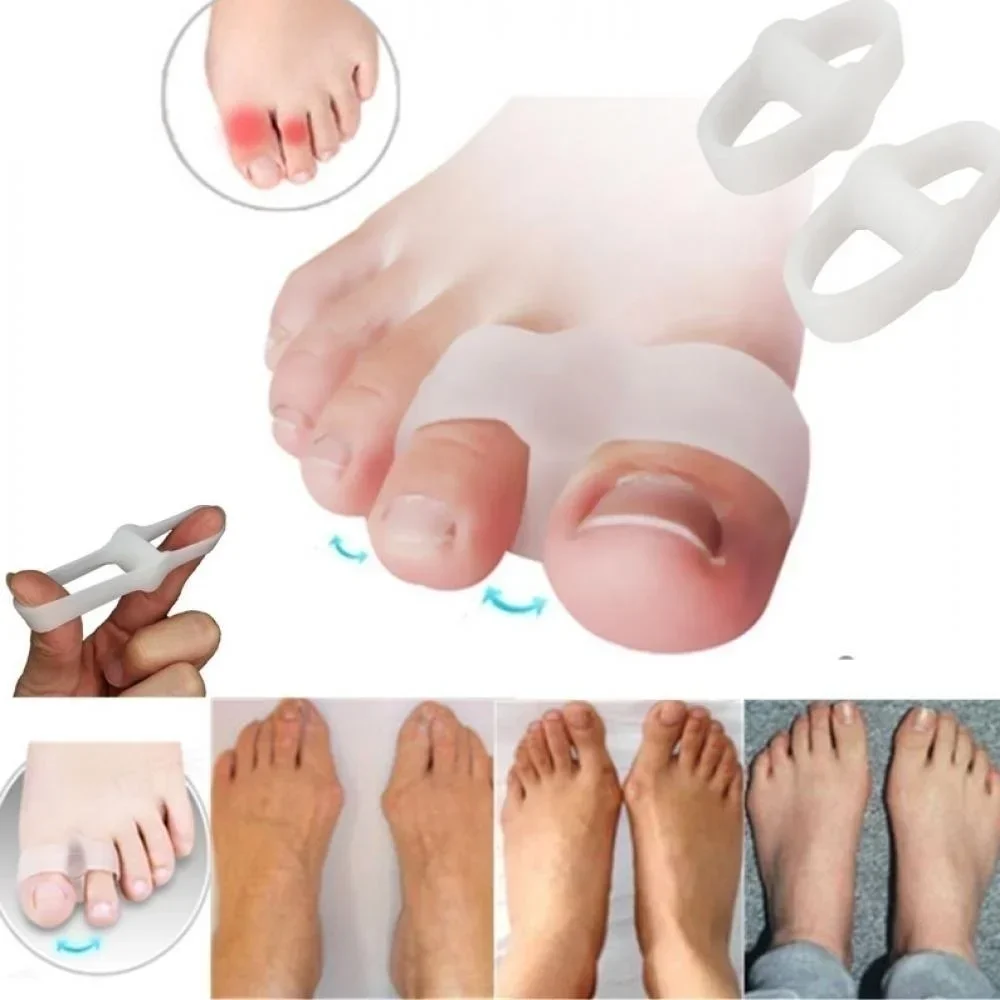 Correction Fluid White - 2 หลุม Bunion Corrector บรรเทาอาการปวด Toe